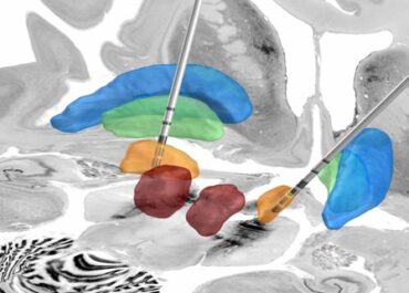 Necesitamos tu ayuda: colabora en esta investigación sobre calidad de vida y neuroestimulación