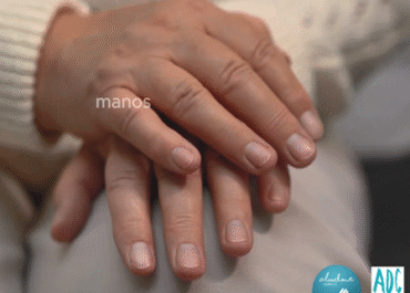 Decimoquinta entrega de la campaña "Aprendemos sobre distonía". Distonía mioclónica: cuando el cuerpo pulsa en dos tiempos